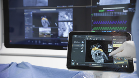 Flujo de trabajo de radiolog&iacute;a flexible