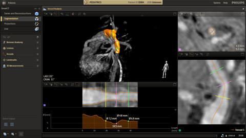 Flujo de trabajo de radiolog&iacute;a flexible
